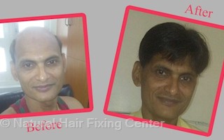 Natural Hair Fixing Center In Falnir Mangalore 575001 Sulekha