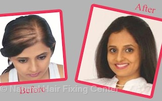 Natural Hair Fixing Center In Falnir Mangalore 575001 Sulekha