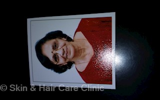 Skin Hair Care Clinic In Antop Hill Mumbai 400037 Sulekha Mumbai