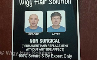 Wigy Hair Solution in Paharganj, Delhi-110055 | Sulekha Delhi