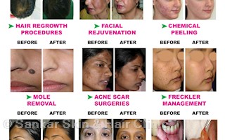 skin & hair clinic near me