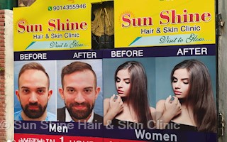 Sun Shine Hair Skin Clinic In Kukatpally Hyderabad 500072 Sulekha Hyderabad