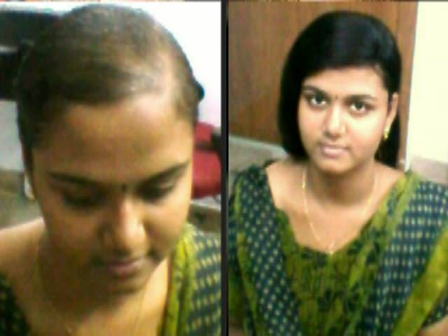 Natural Hair Fixing Center in Falnir, Mangalore-575001 | Sulekha Mangalore