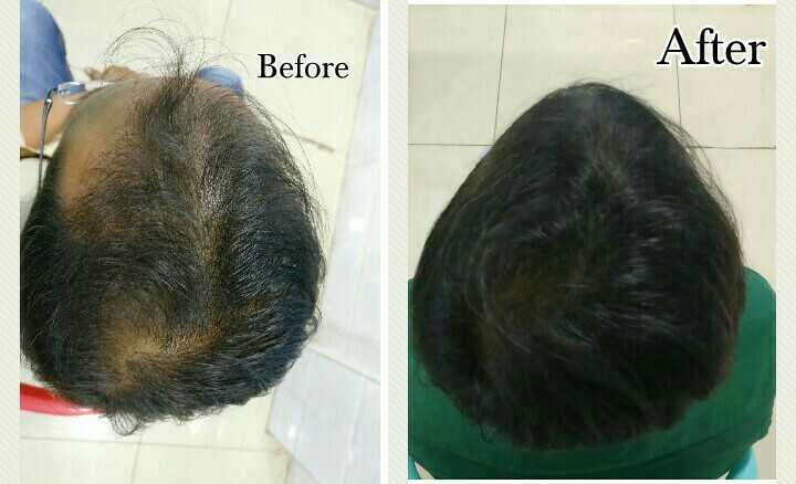 Sankar Skin and Hair Clinic MultiSpeciality Clinic in Suchitra Circle  Hyderabad  Book Appointment View Fees Feedbacks  Practo