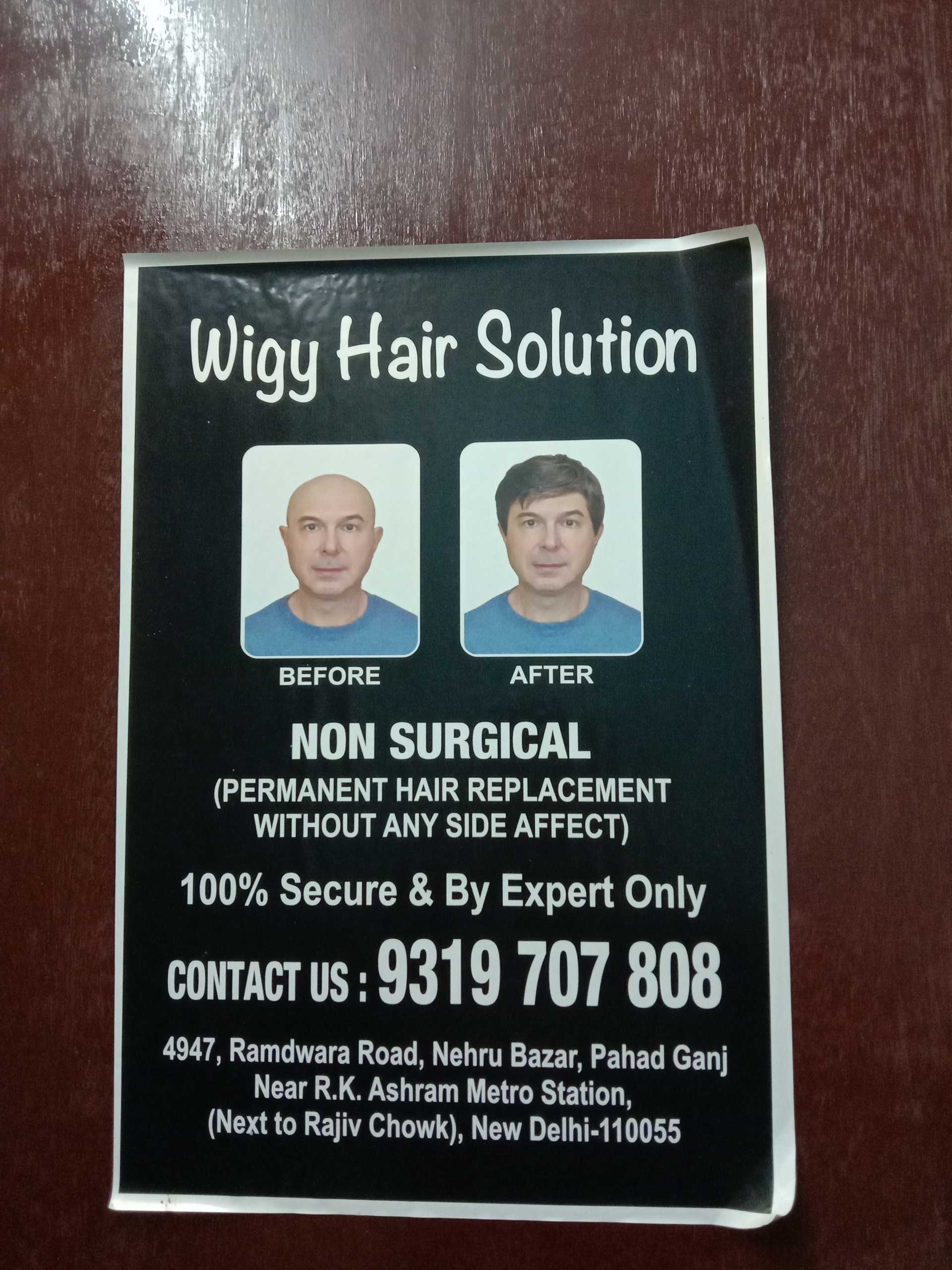 Wigy Hair Solution in Paharganj, Delhi-110055 | Sulekha Delhi Wigy Hair Solution in Paharganj, Delhi-110055 | Sulekha Delhi