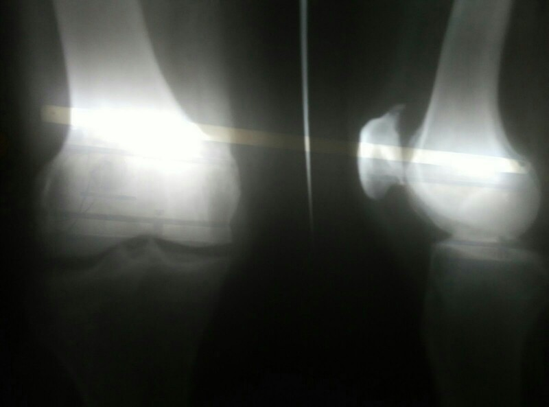 Sun Physiotherapy & Weight Loss Centre in Kamarajar Salai, Madurai