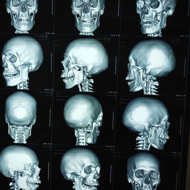 AYURVEDA JOD JEEVAN HOSPITAL in Patna City, Patna800008 Sulekha Patna