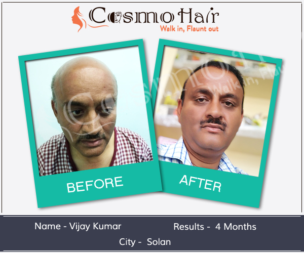 Soumya Skin  Hair Clinic in New Delhi India