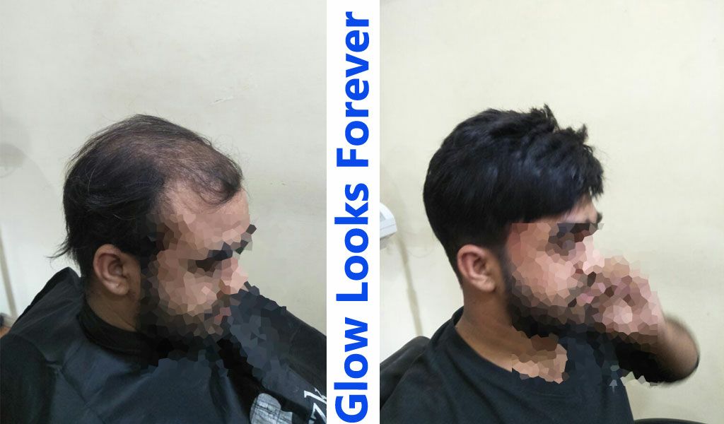 Glow Looks in Wardhaman Nagar, Nagpur-440008 | Sulekha Nagpur Glow Looks in Wardhaman Nagar, Nagpur-440008 | Sulekha Nagpur