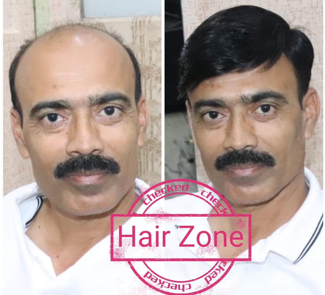 Hair Zone in Rohtak Road, Delhi-110087 | Sulekha Delhi