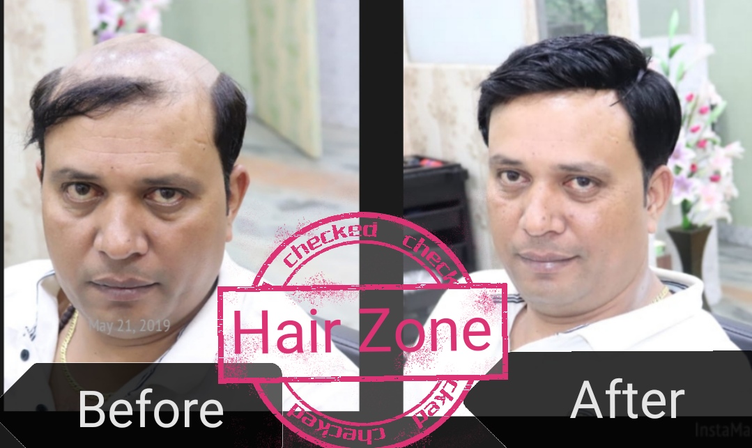 Hair Zone in Rohtak Road, Delhi-110087 | Sulekha Delhi