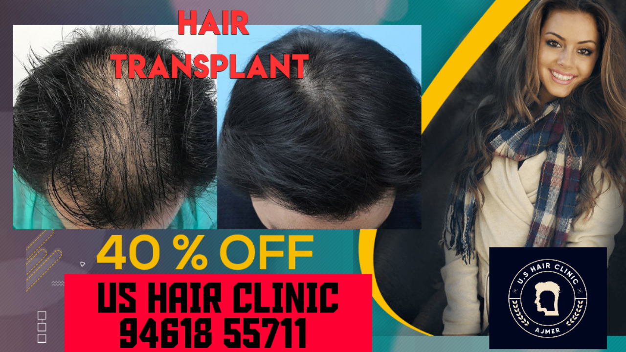 Us hair clinic in Vaishali Nagar, Ajmer-305001 | Sulekha Ajmer