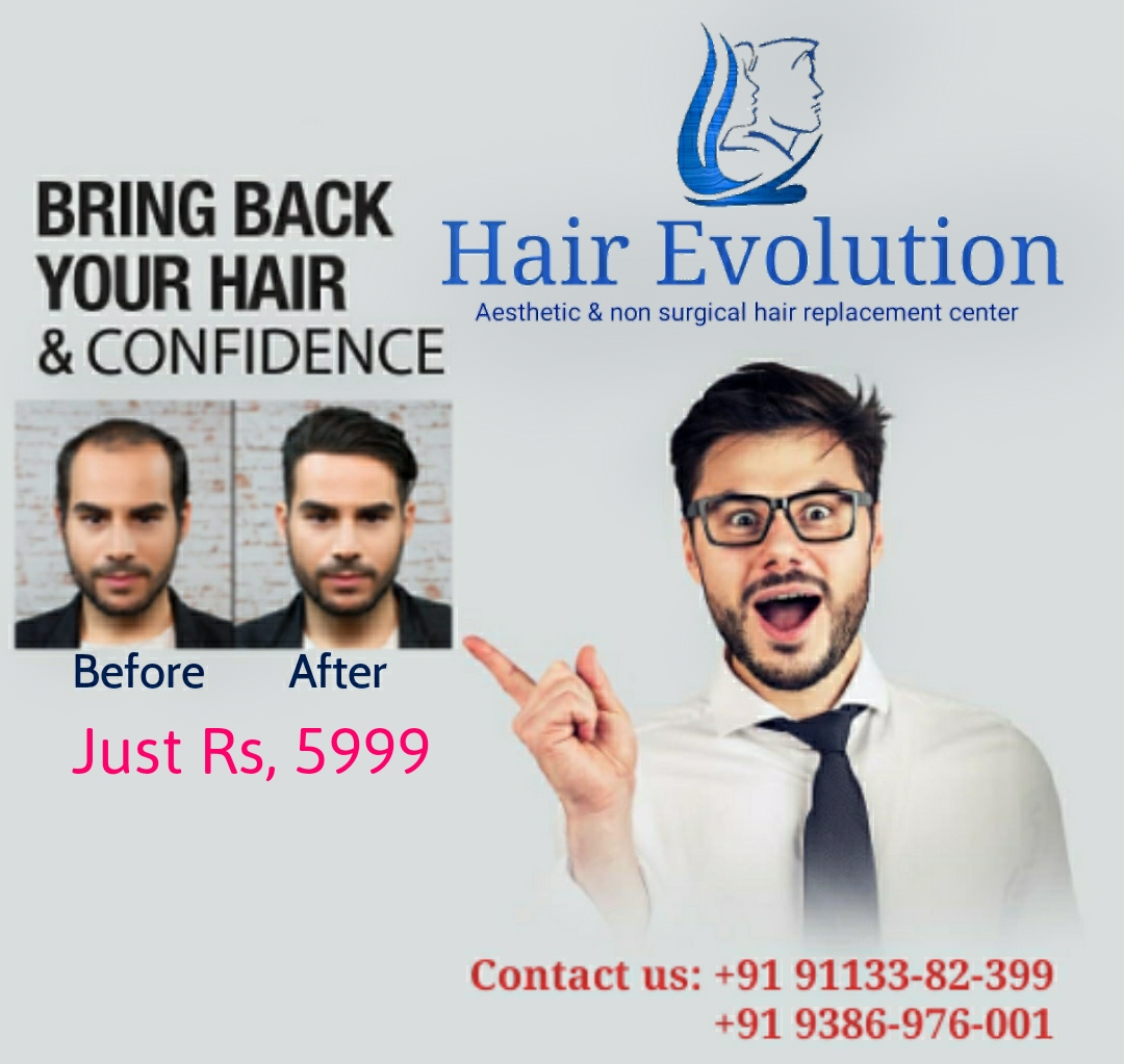 Hair Evolution ( Aesthetic and Non Surgical Hair Replacement Center ) in  Kankarbagh, Patna-800020 | Sulekha Patna