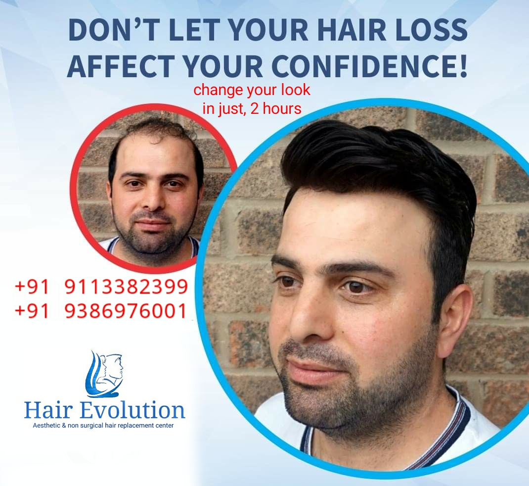 Hair Evolution ( Aesthetic and Non Surgical Hair Replacement Center ) in  Kankarbagh, Patna-800020 | Sulekha Patna