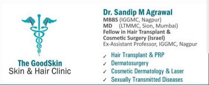 Hair Transplantation in Nagpur हयर टरसपलटशन नगपर