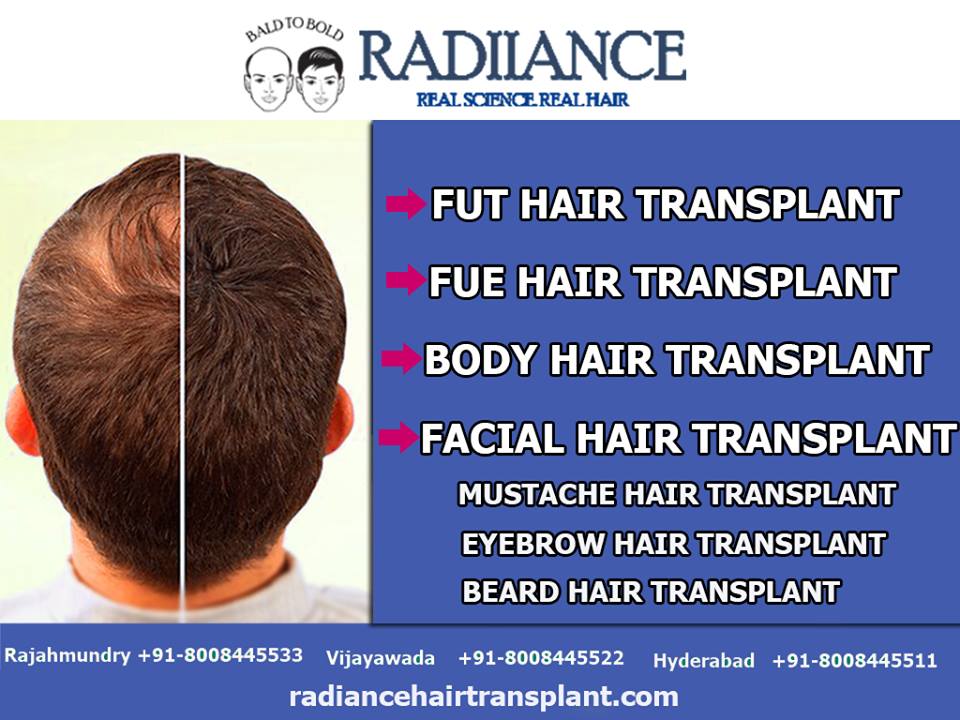 Radiance Hair Transplant Center in Ameerpet, Hyderabad-500073 | Sulekha  Hyderabad